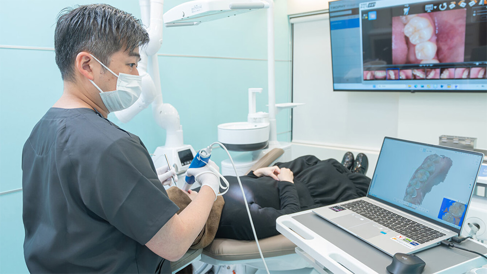 口腔内スキャナー