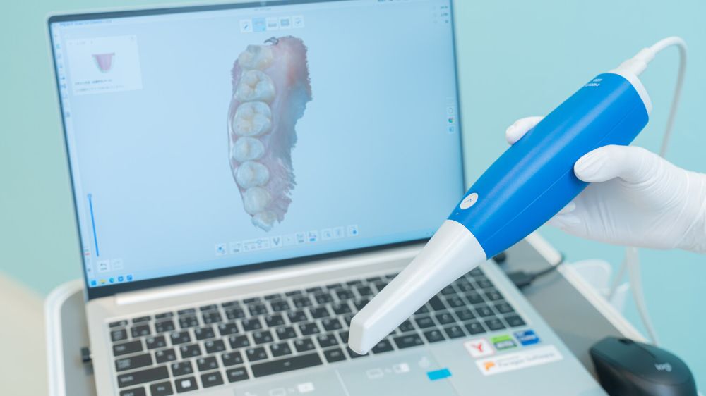 口腔内スキャナー