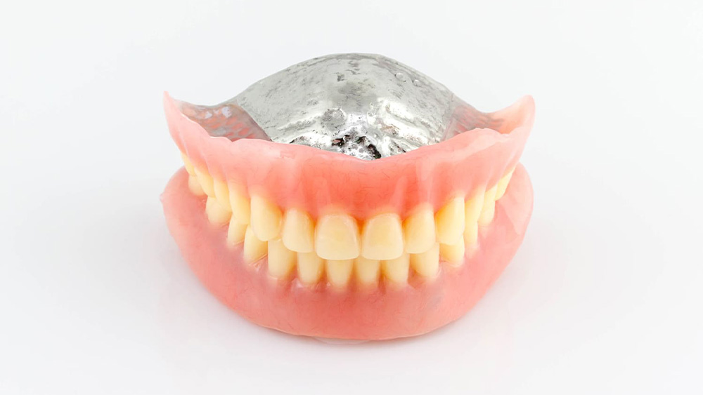 金属床義歯