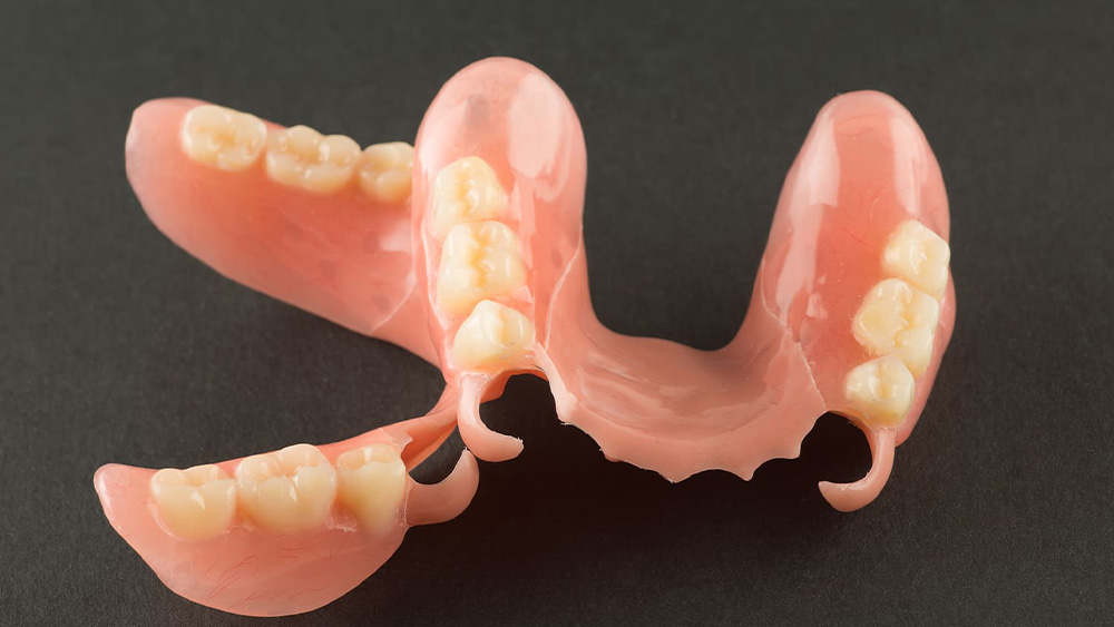 ノンクラスプデンチャー