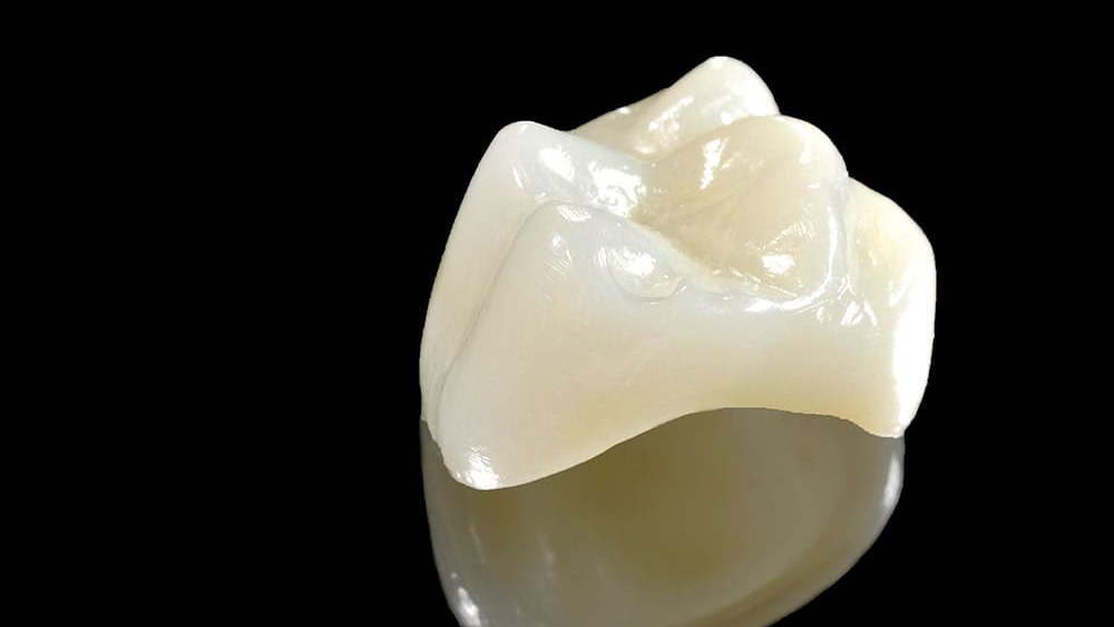 セラミック治療