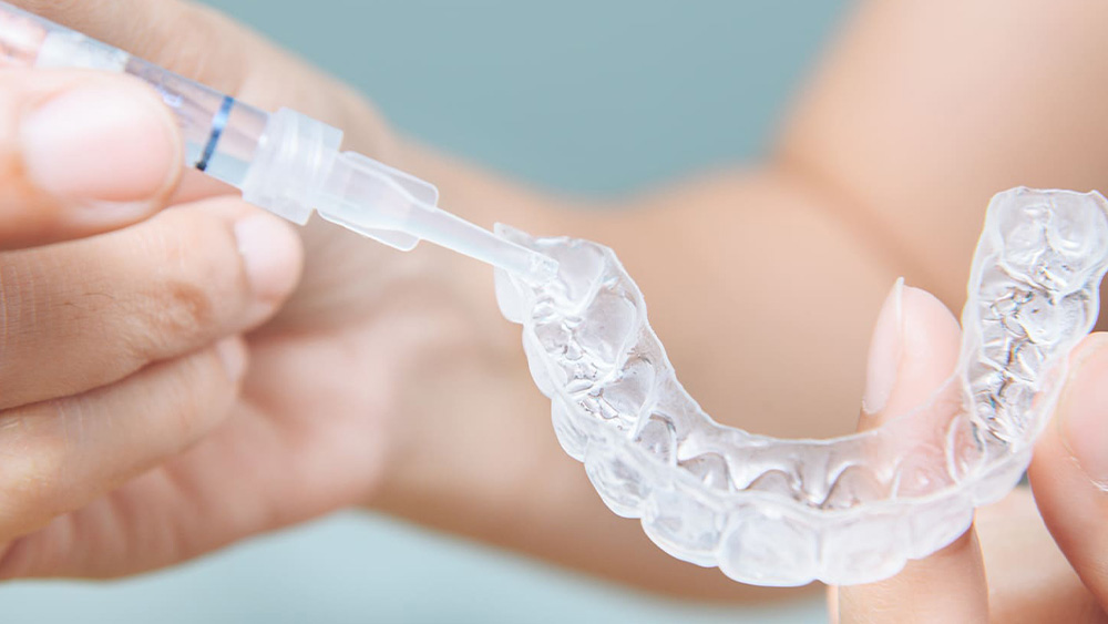 ホームホワイトニング