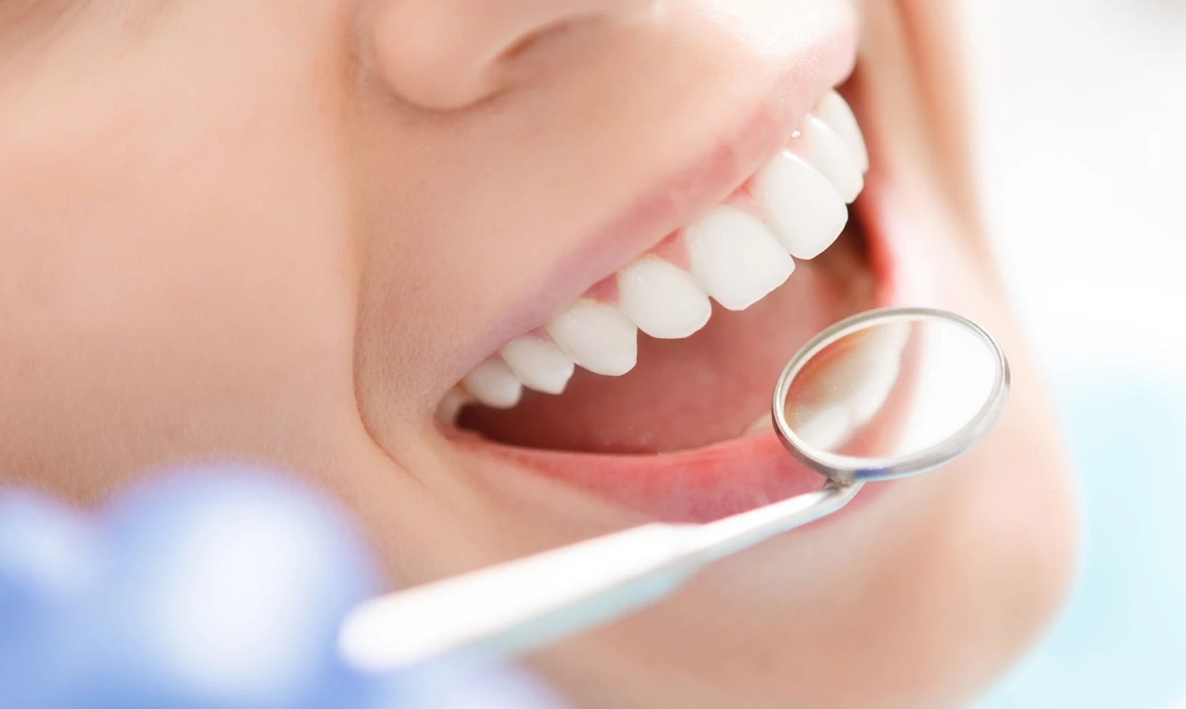 定期メンテナンスの診療風景